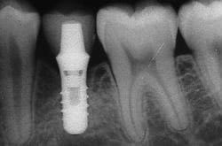 patient 1 x-ray