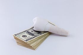 implant and money representing cost of dental implants in Dallas