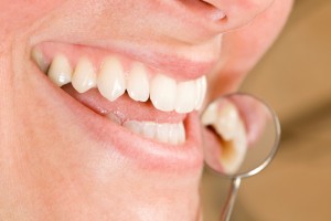 Your Dallas prosthodontist recommends good oral hygiene.